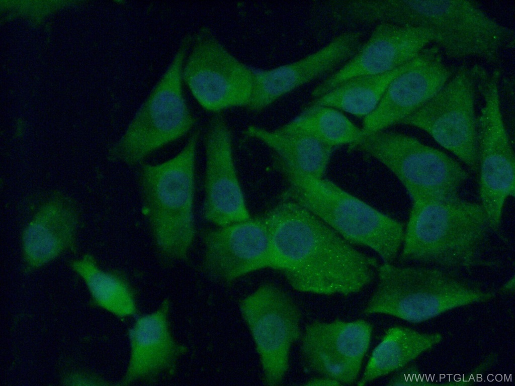 CTHRC1 Polyclonal antibody