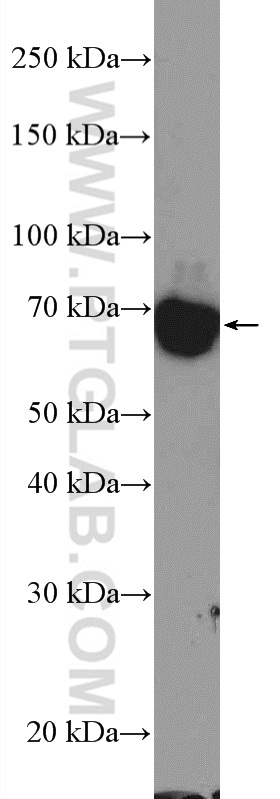 TOP1MT Polyclonal antibody