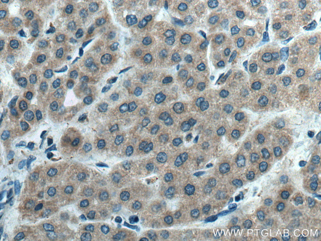 CYP2C8/9/18/19 Polyclonal antibody