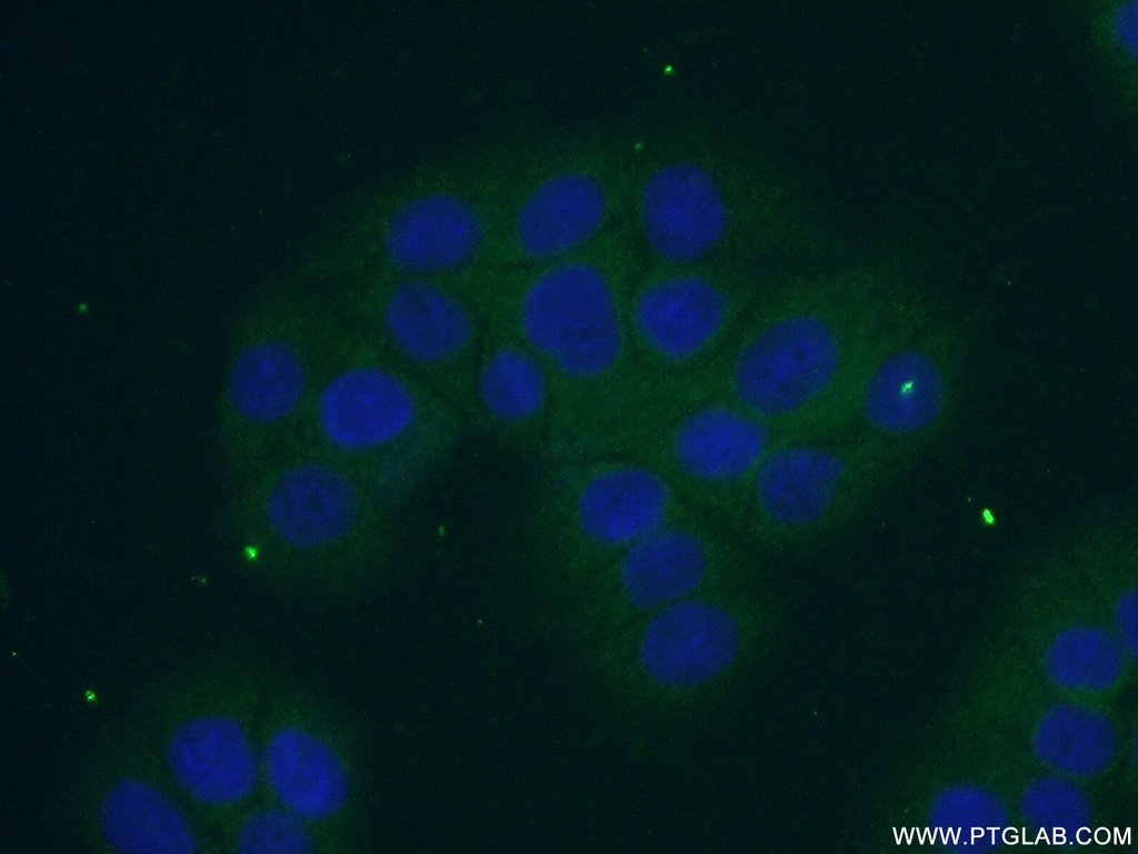 SMPDL3B Polyclonal antibody