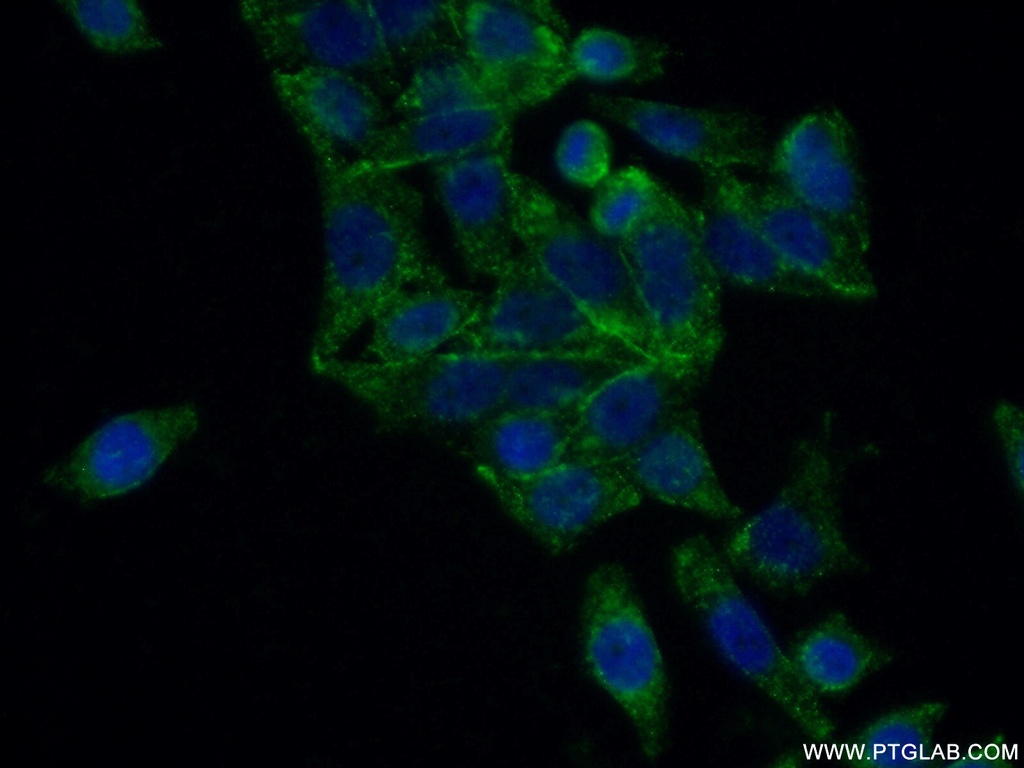 FUT6 Polyclonal antibody