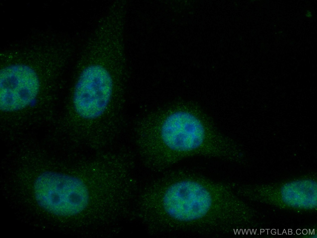 MED31 Polyclonal antibody