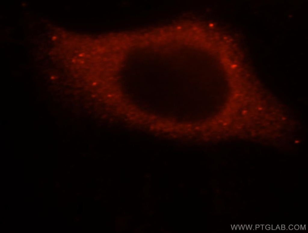 SMAP2 Polyclonal antibody