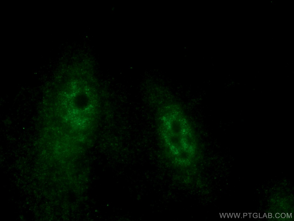 HEXIM2 Polyclonal antibody