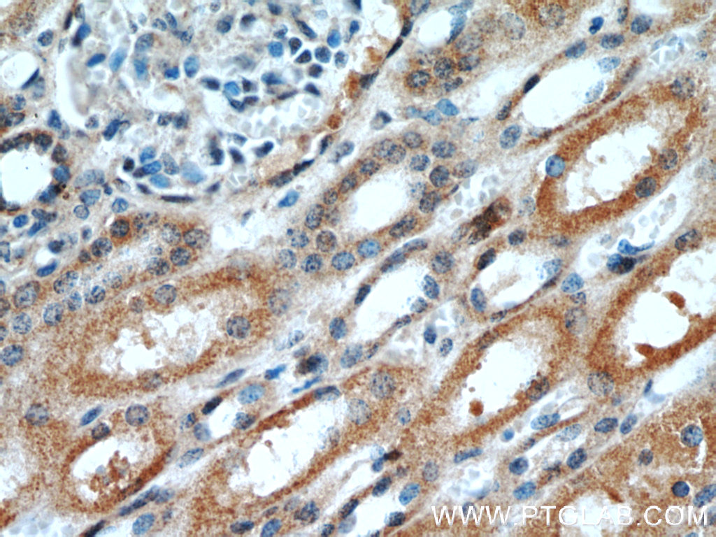 OTUD7B Polyclonal antibody
