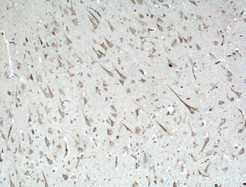 KCNMB2 Polyclonal antibody