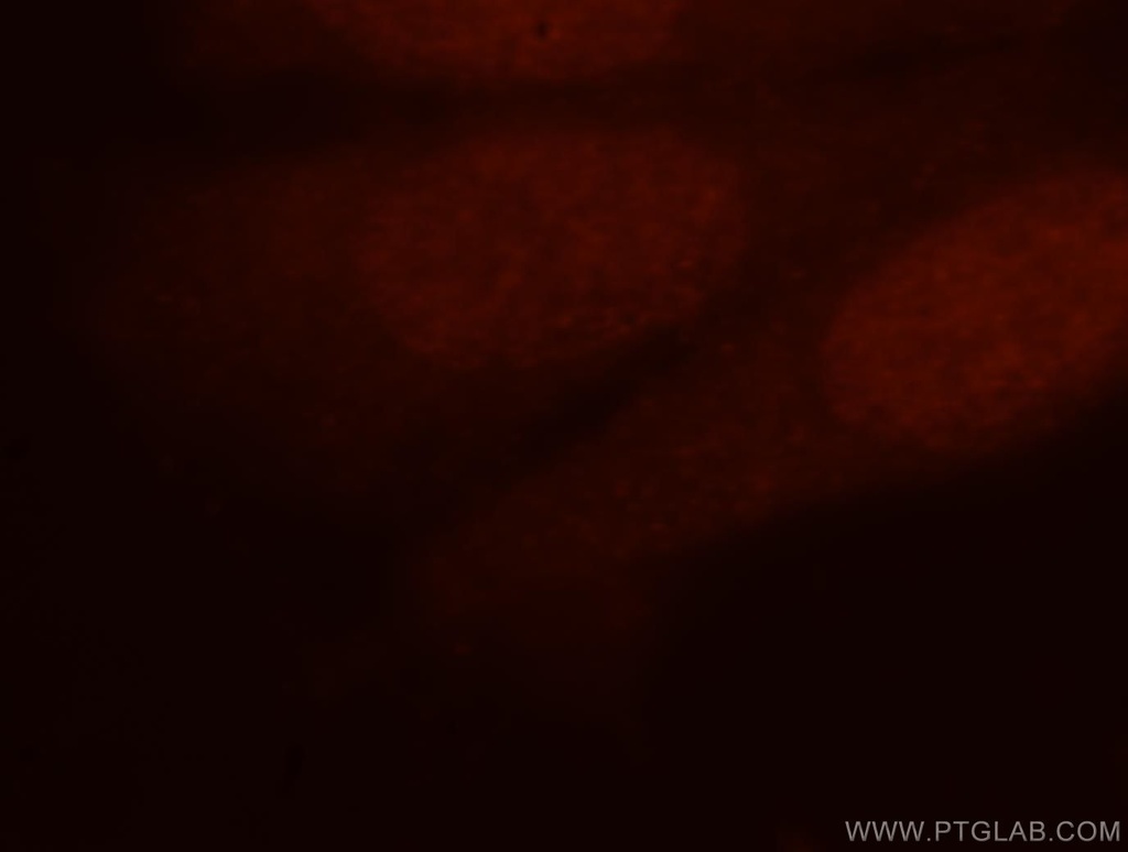 CDKN2AIP Polyclonal antibody