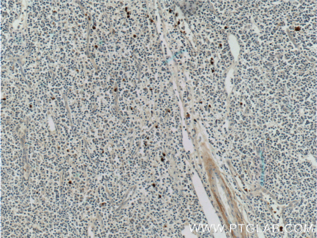S100A12 Polyclonal antibody