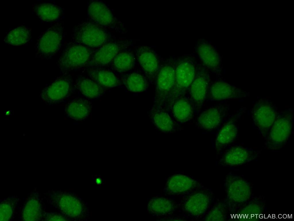 HDDC2 Polyclonal antibody