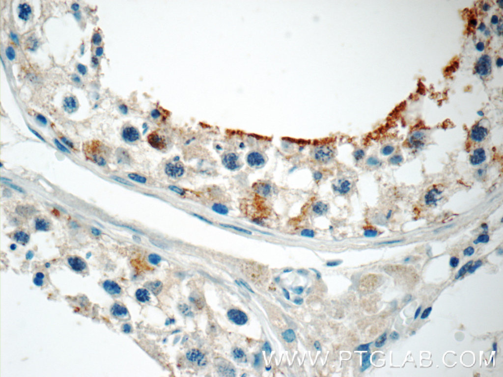 ZER1 Polyclonal antibody