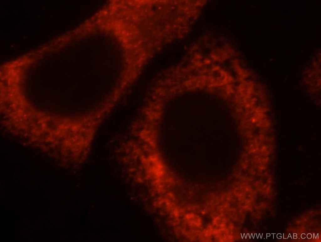 RPL28 Polyclonal antibody