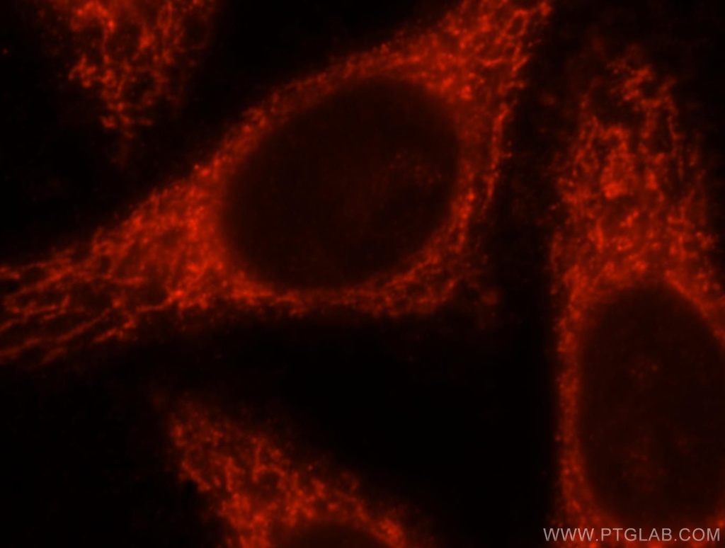 MRPL10 Polyclonal antibody