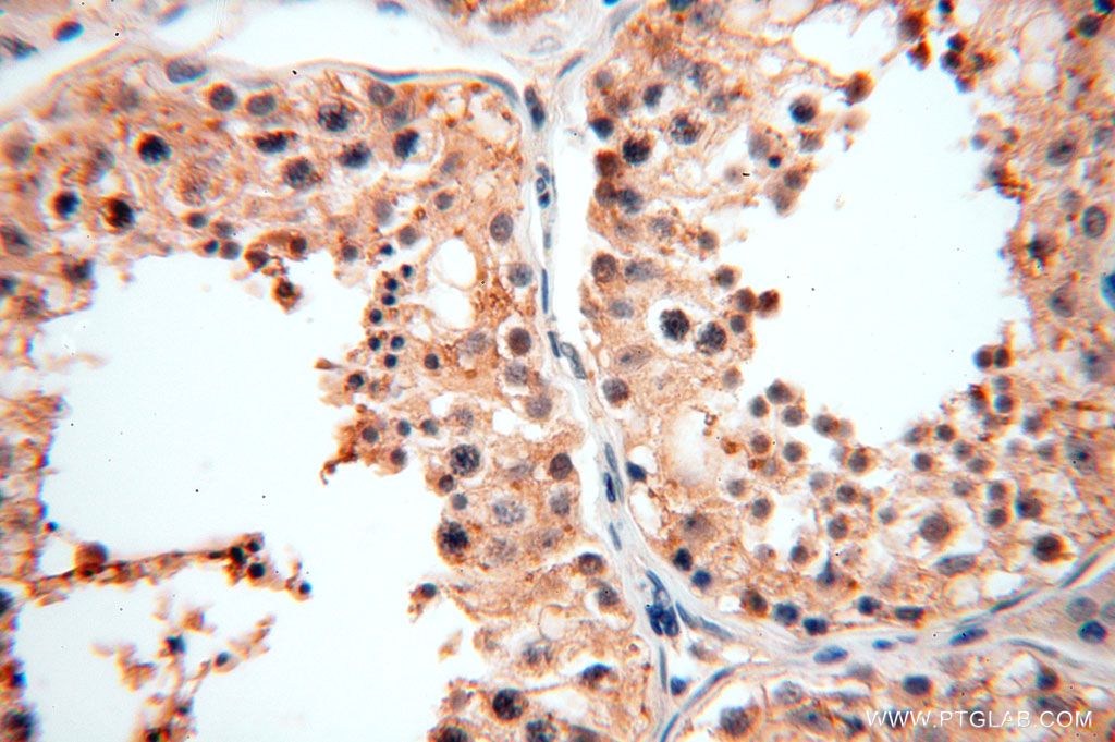 SPATA19 Polyclonal antibody