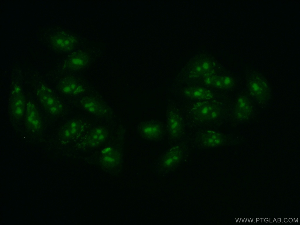 DDX52 Polyclonal antibody