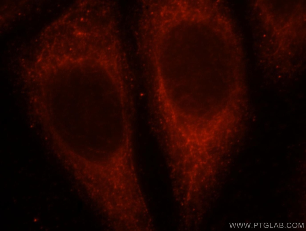 UGT2B7 Polyclonal antibody