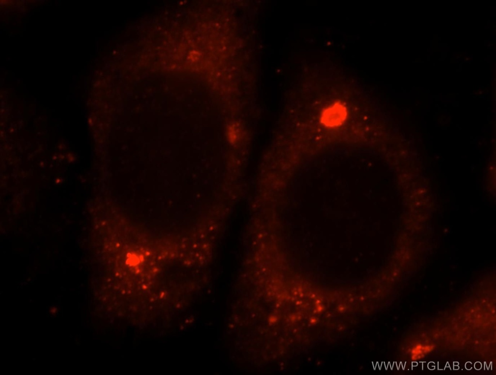 GTDC1 Polyclonal antibody
