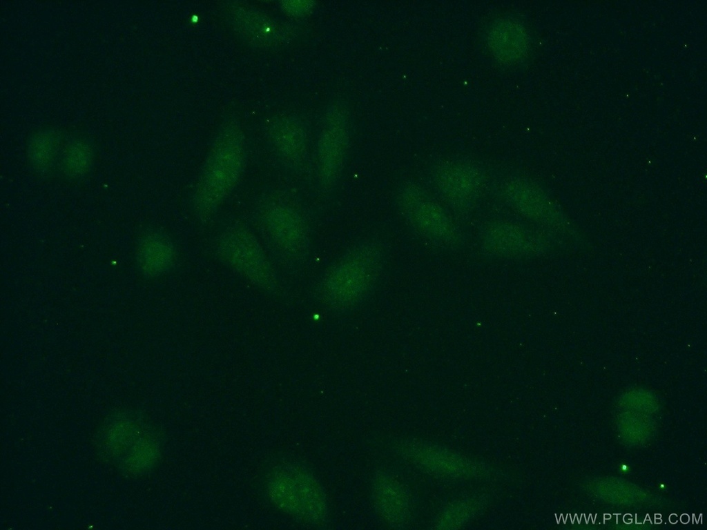 POLR1D Polyclonal antibody