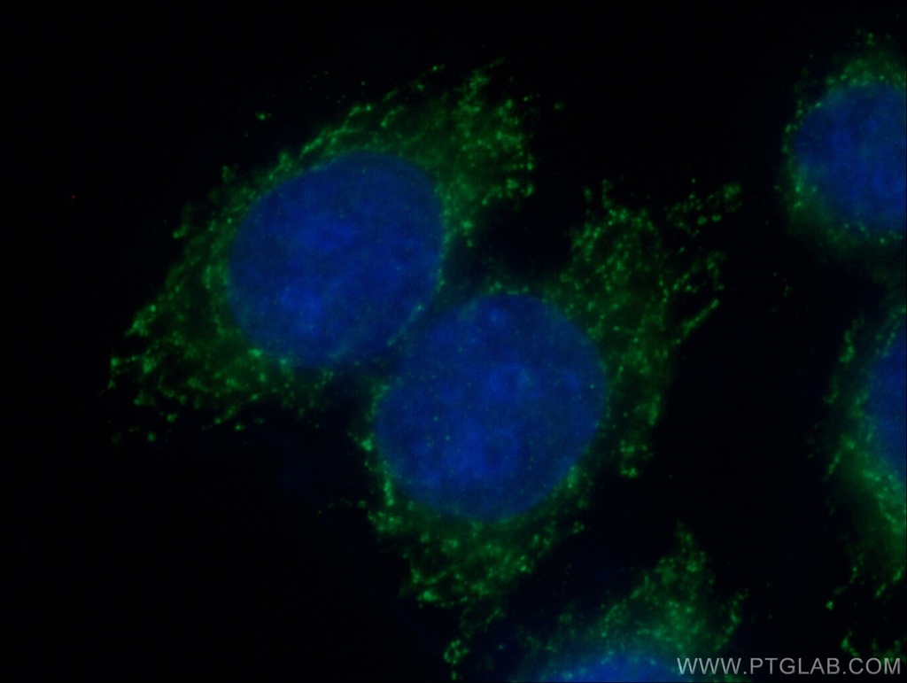 RPS13 Polyclonal antibody