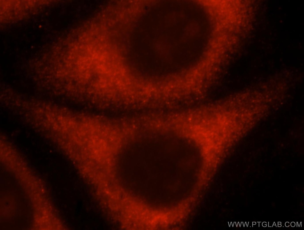 RPL10A Polyclonal antibody