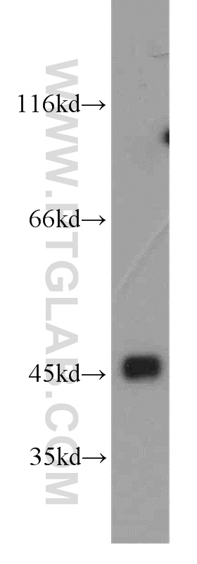 Cytohesin 3 Polyclonal antibody