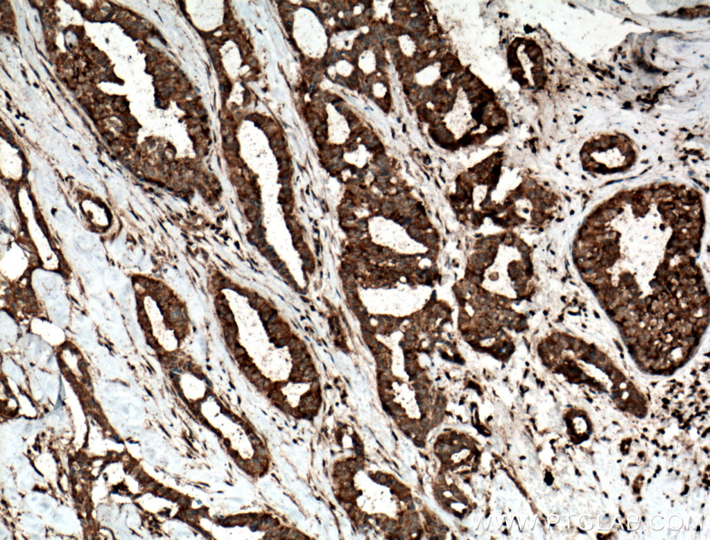 TOMM6 Polyclonal antibody