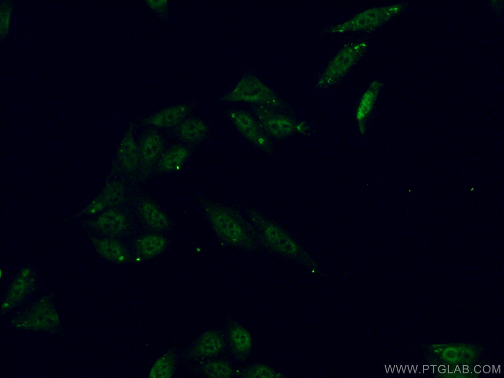 ALY Polyclonal antibody