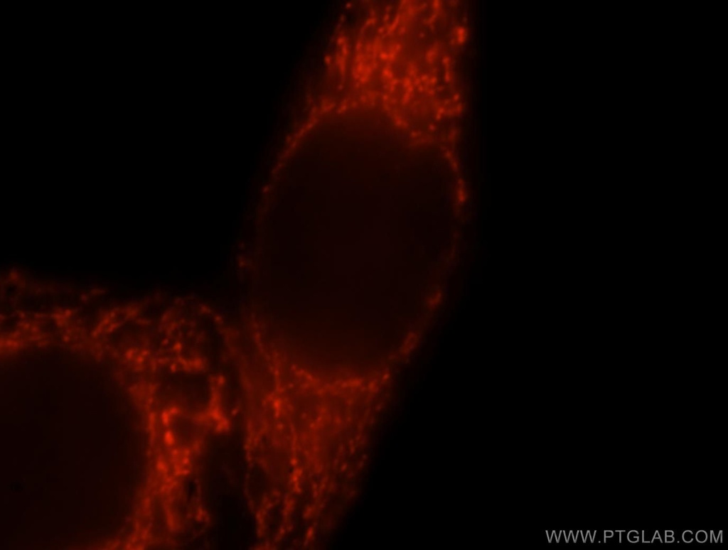 GSTA3 Polyclonal antibody