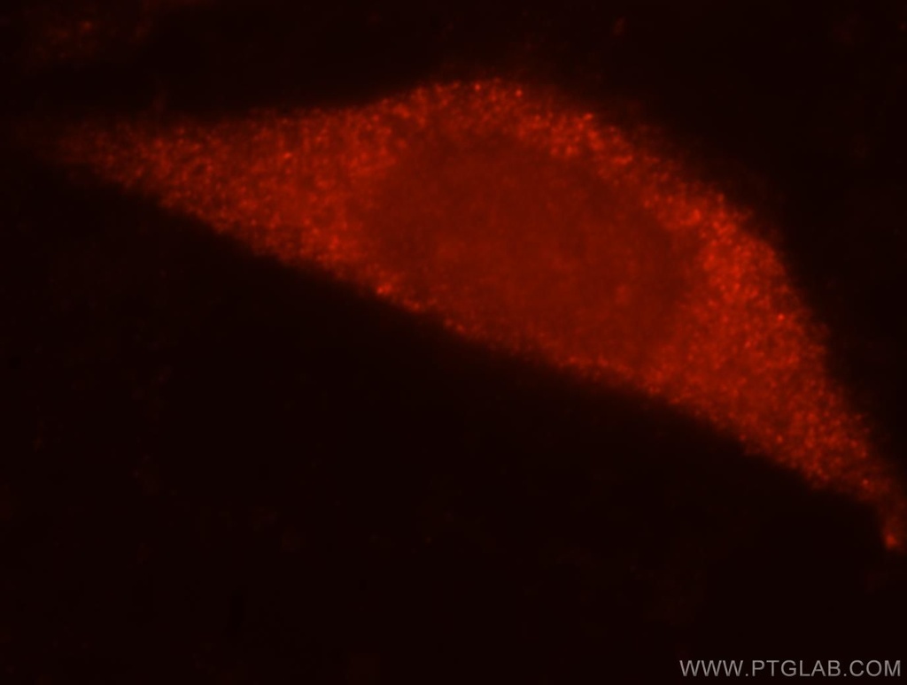 RPL7L1 Polyclonal antibody
