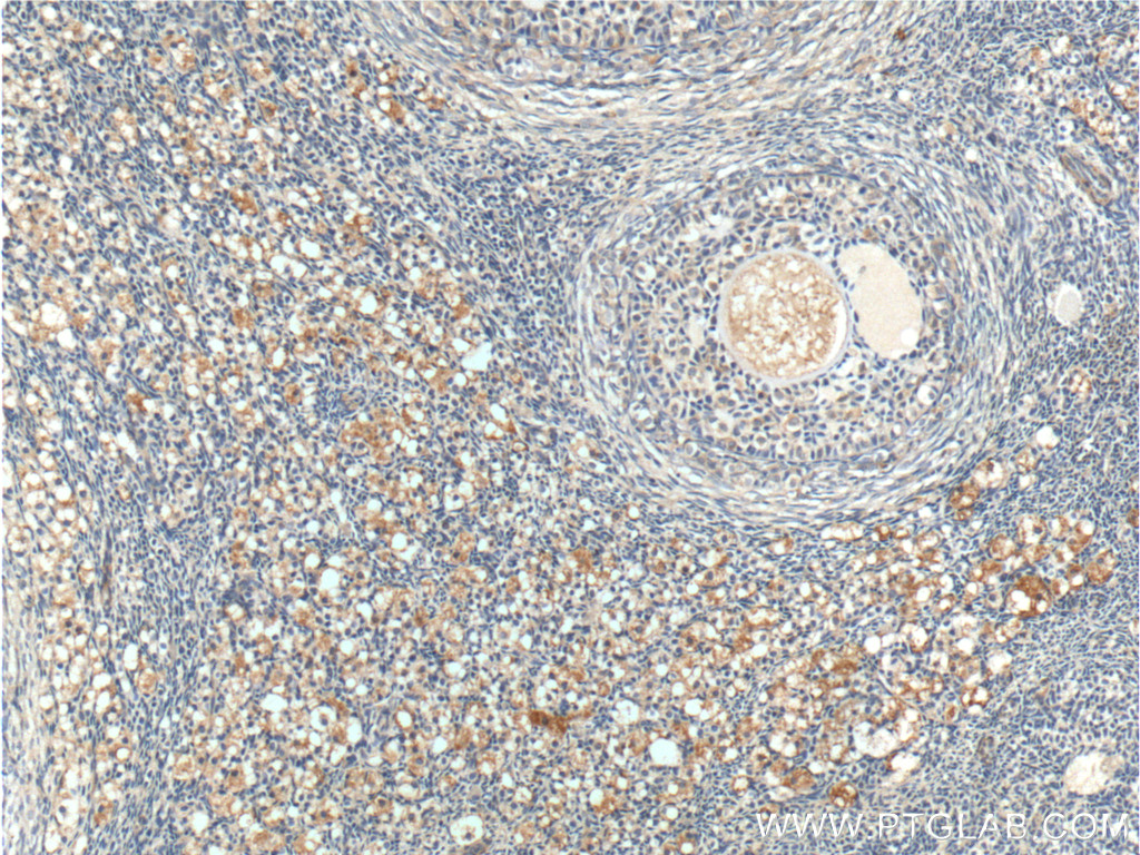 ANTXR2 Polyclonal antibody