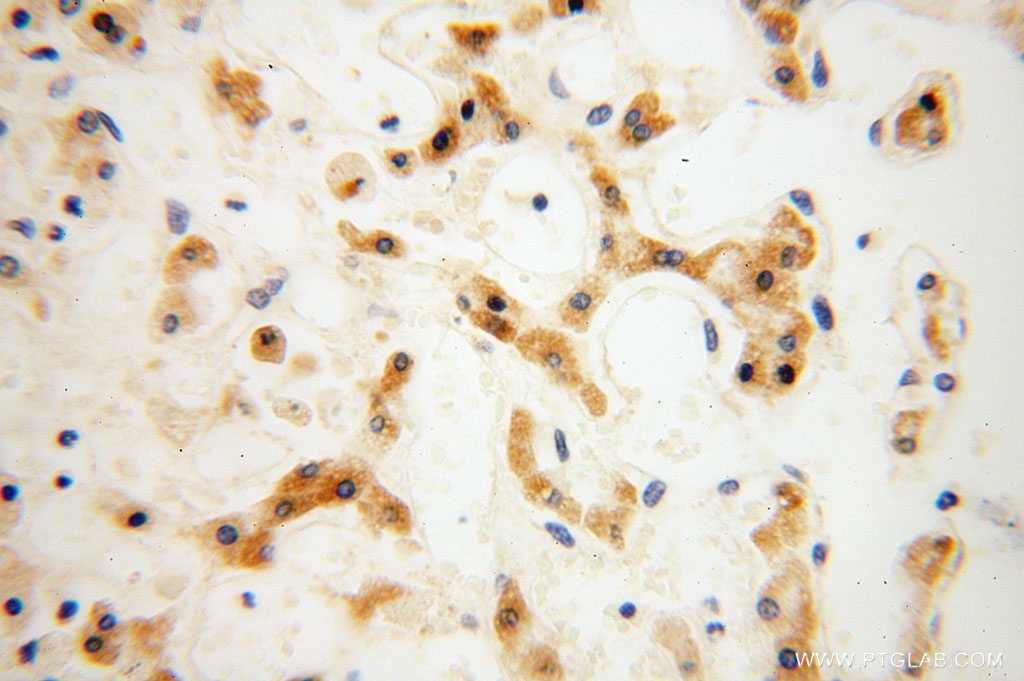 CPOX Polyclonal antibody