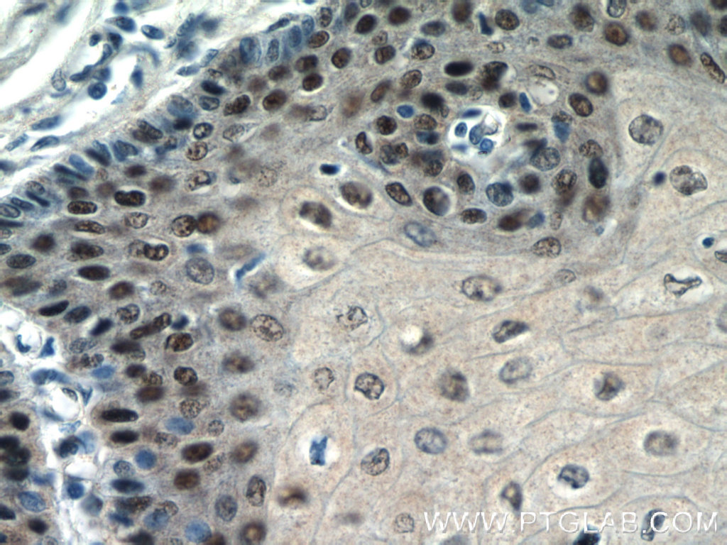 TRMT6 Polyclonal antibody