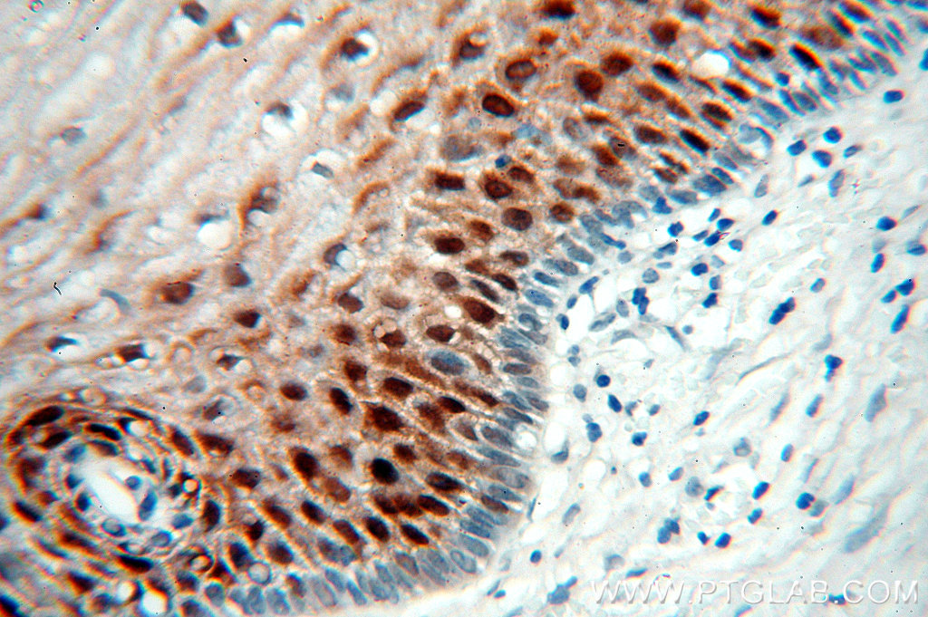 Galectin-7 Polyclonal antibody