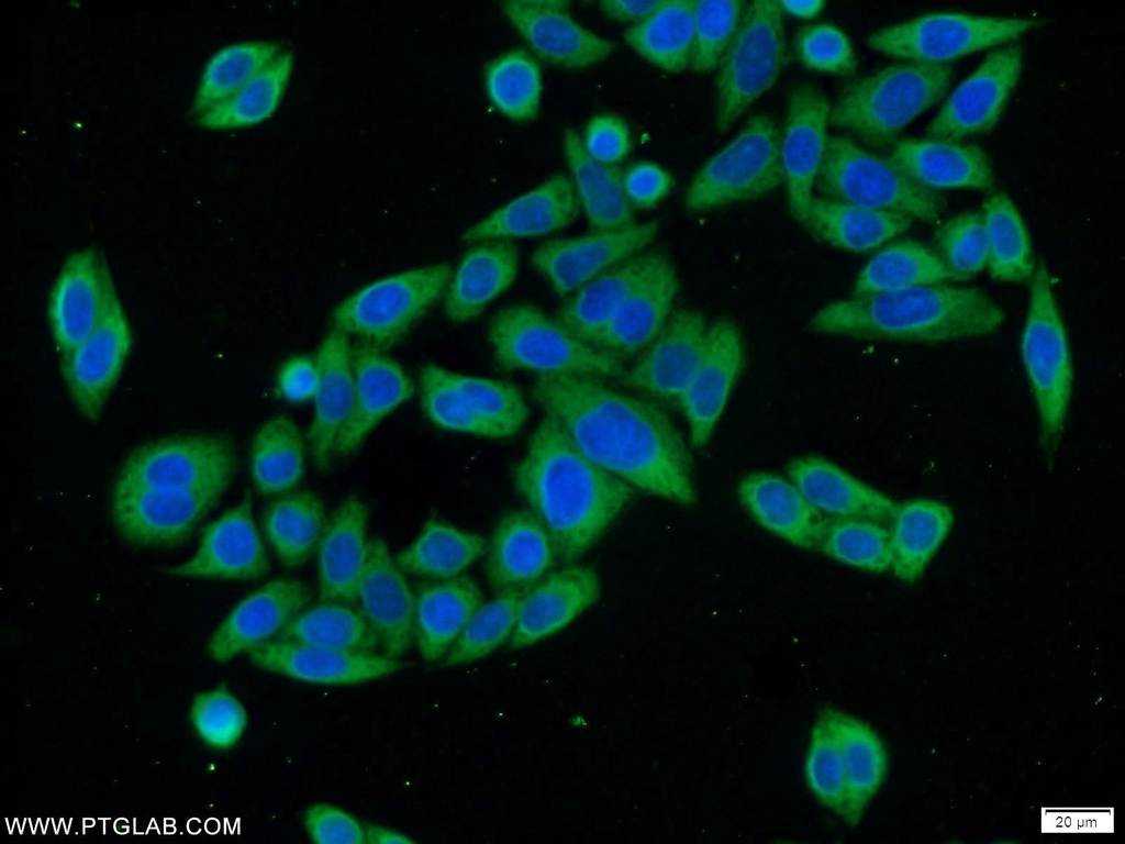 EXOSC10 Polyclonal antibody