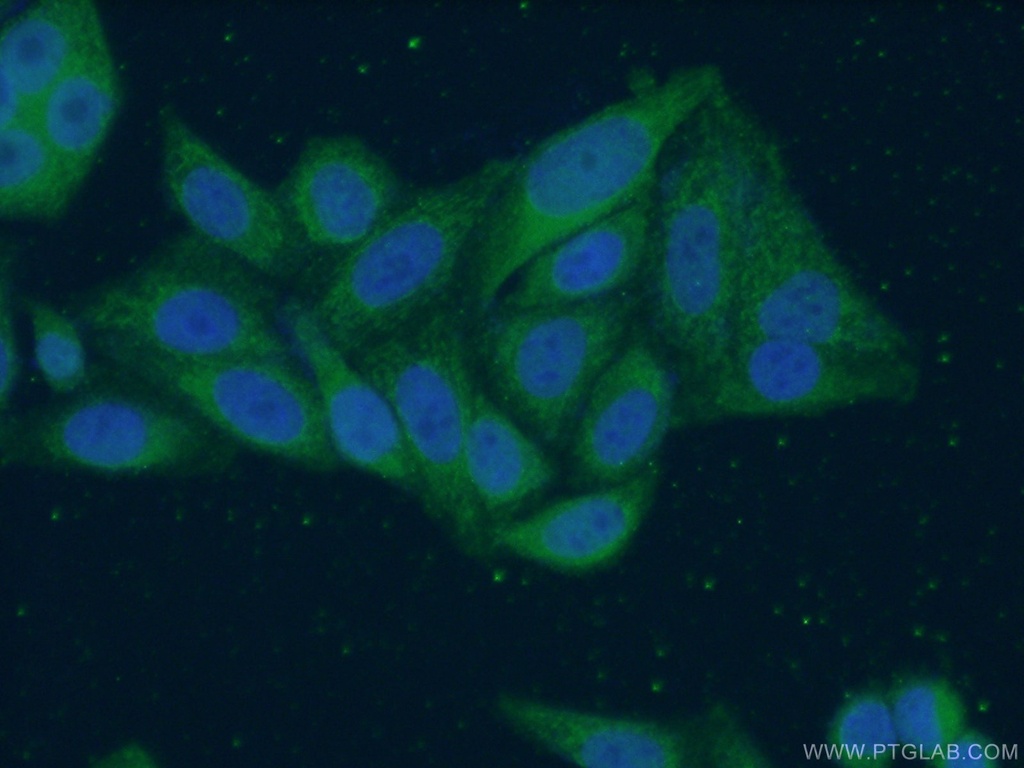 MRPS16 Polyclonal antibody