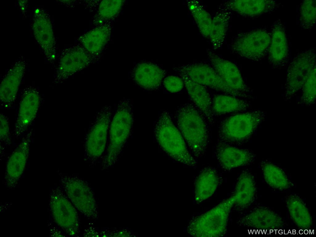 SPOP Polyclonal antibody