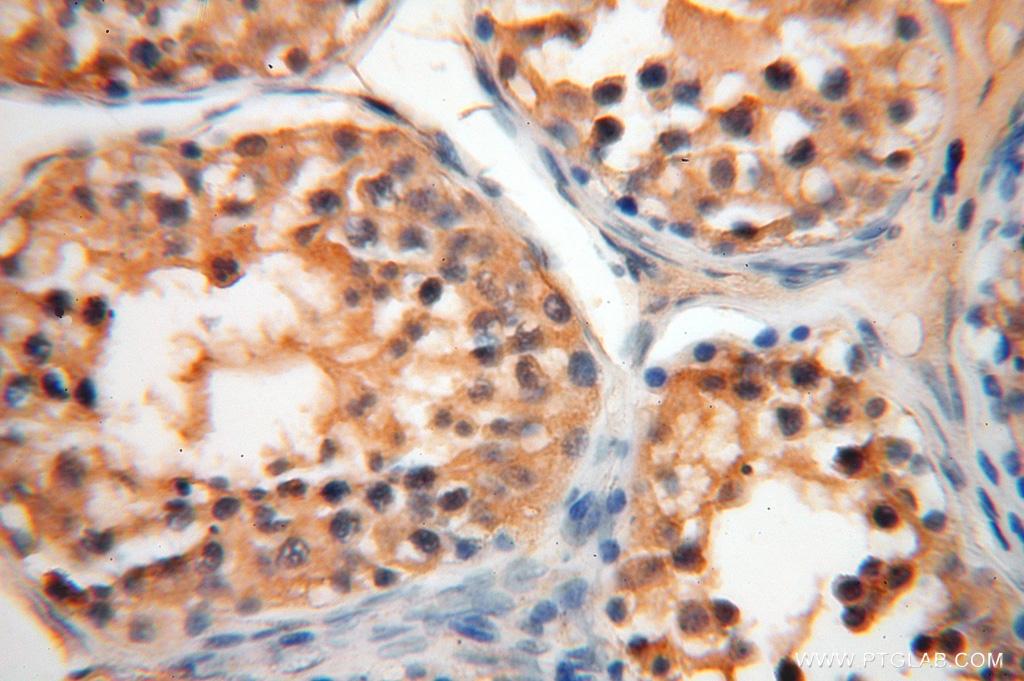 AGPAT6 Polyclonal antibody