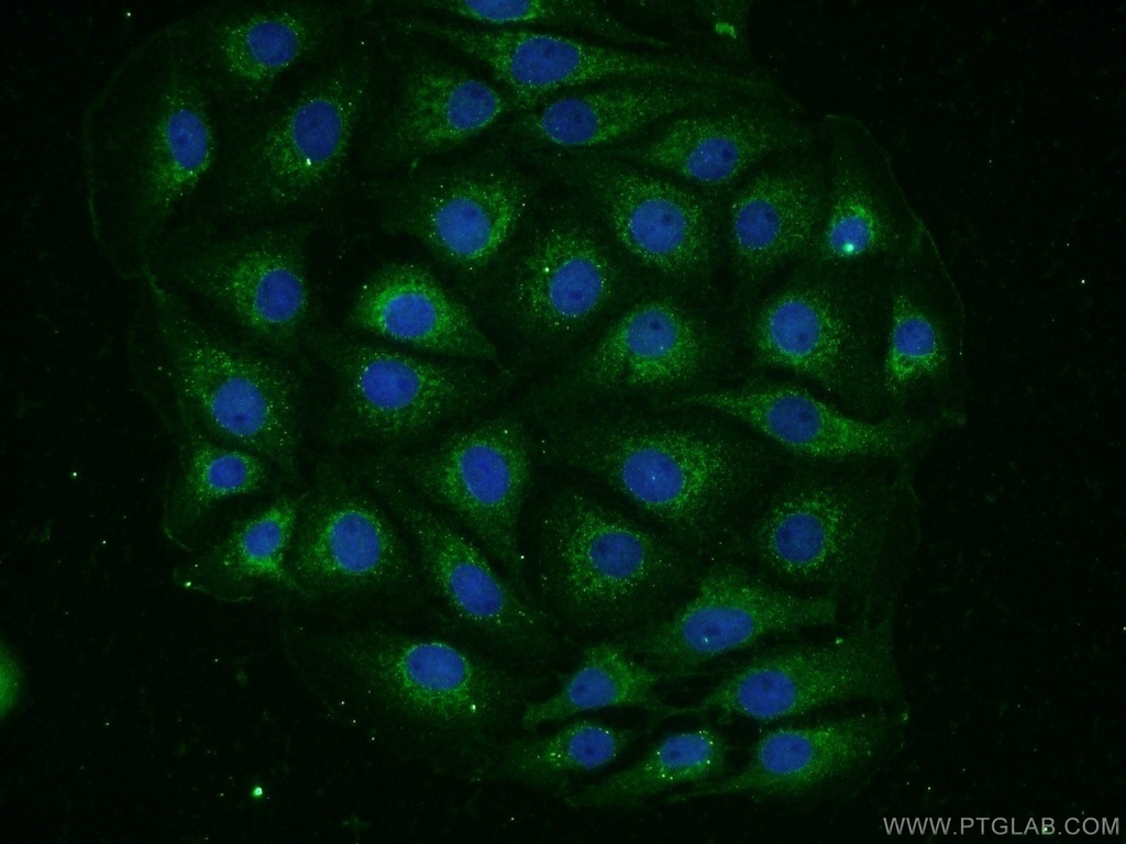 GLT25D1 Polyclonal antibody