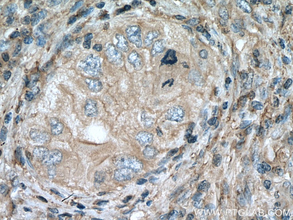 APOC1 Polyclonal antibody