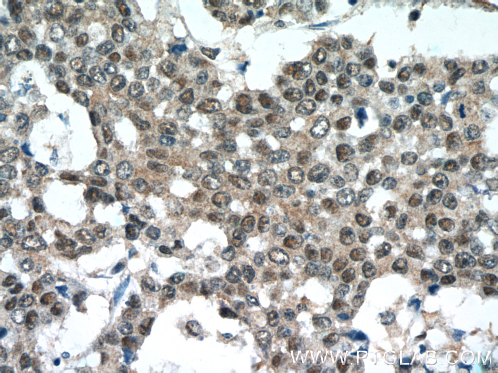 NEDD8 Polyclonal antibody