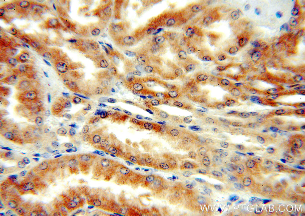 DcR2 Polyclonal antibody