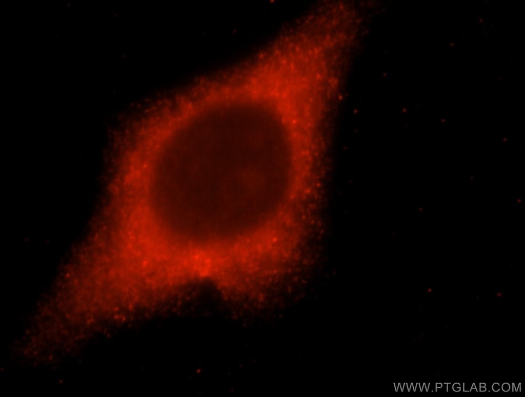 LACTB2 Polyclonal antibody