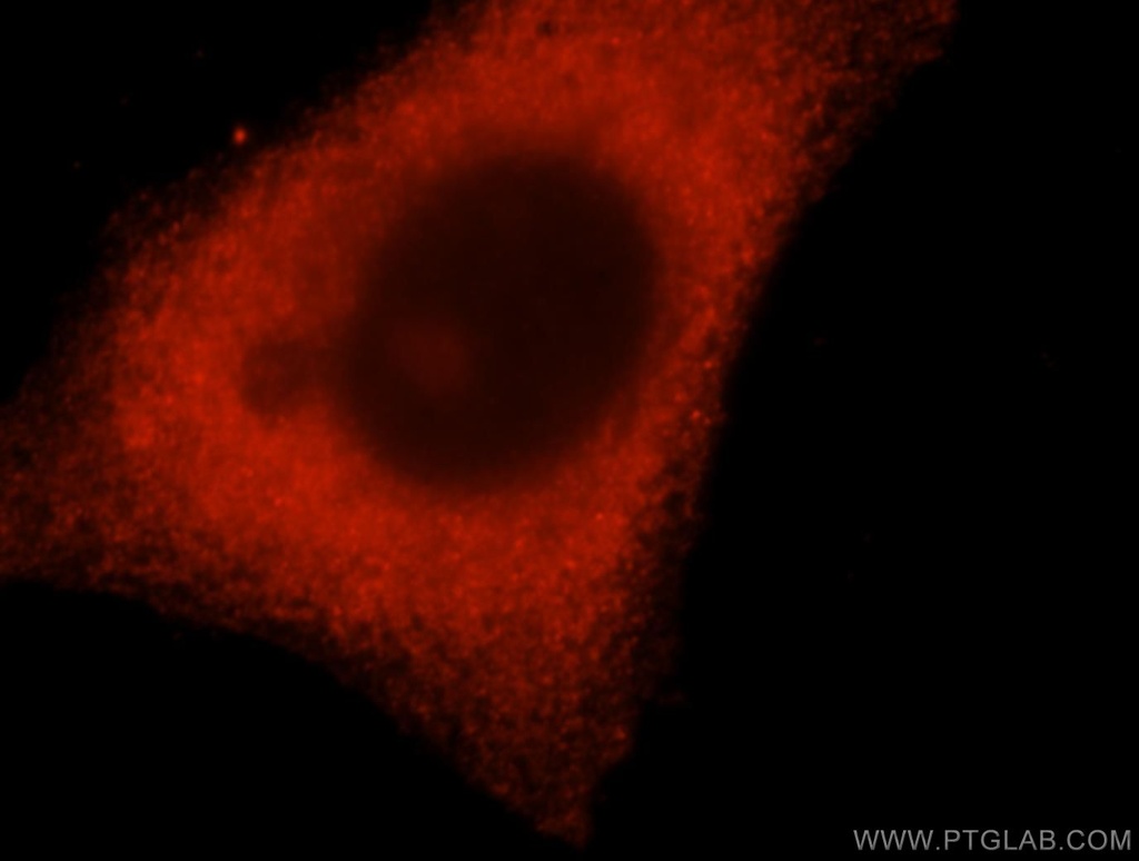DCTD Polyclonal antibody