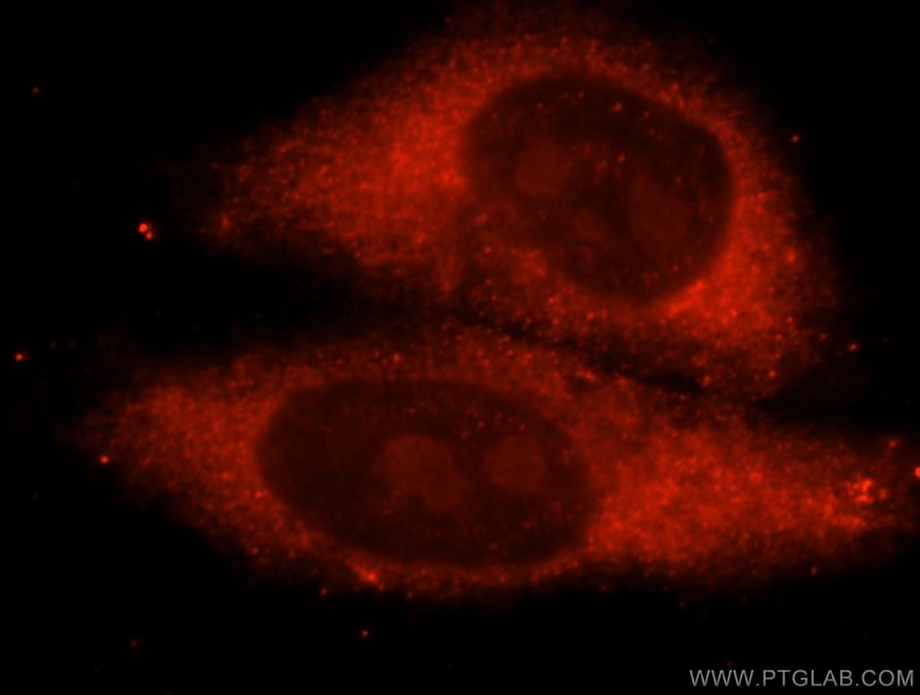 METTL5 Polyclonal antibody