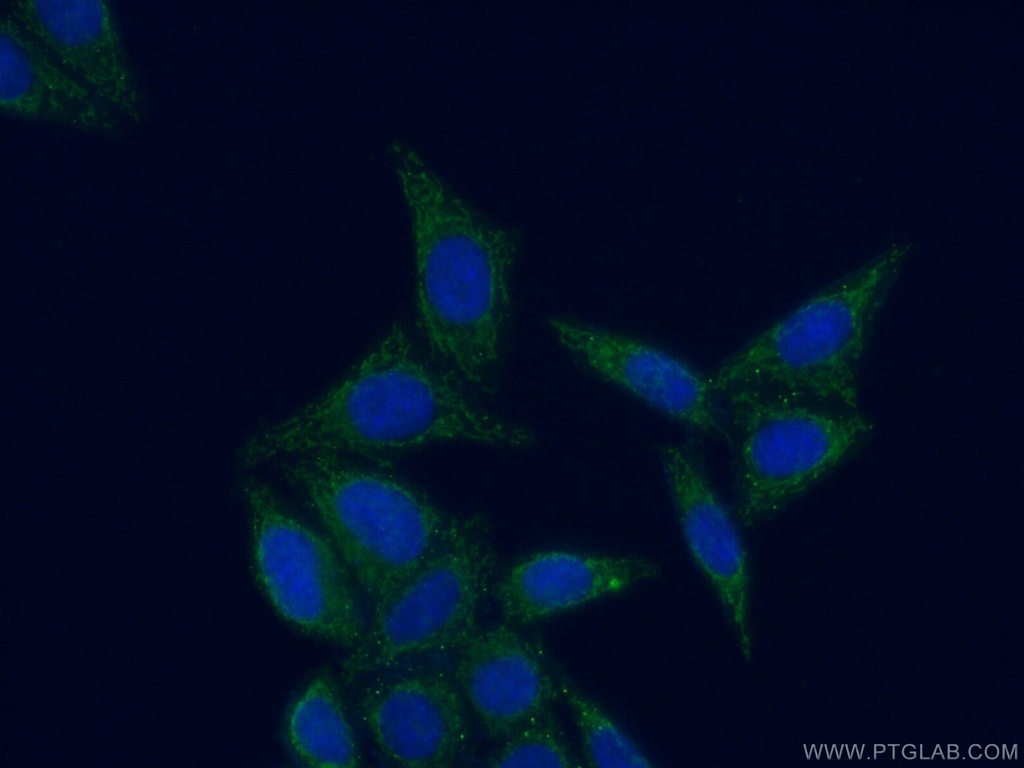 MRPL52 Polyclonal antibody