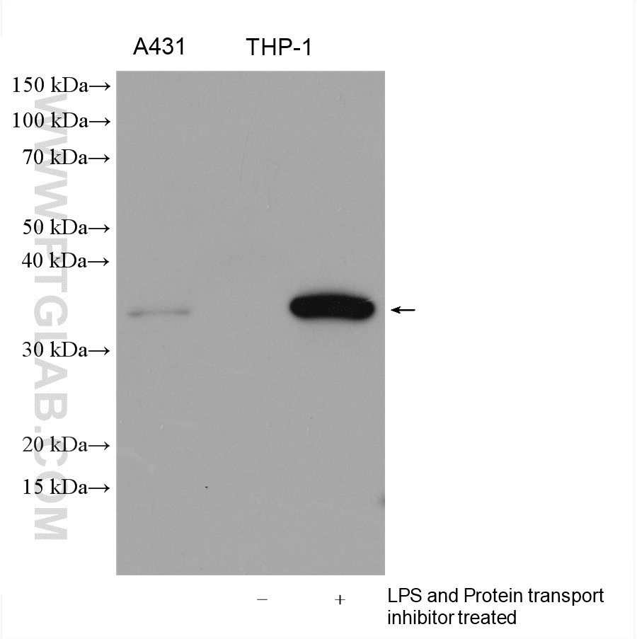 IL-1 Beta Polyclonal antibody