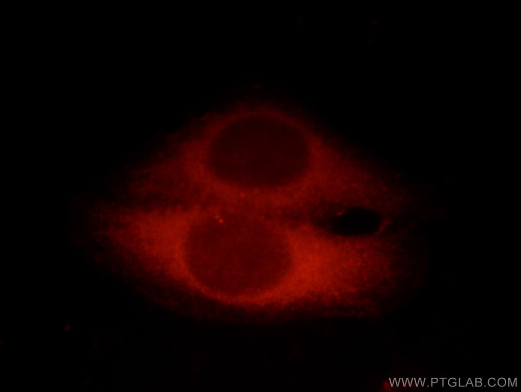 CC2D1A Polyclonal antibody