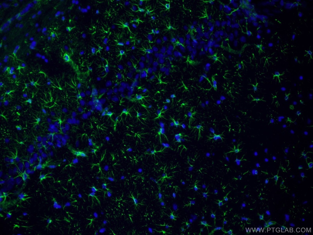 GFAP Polyclonal antibody
