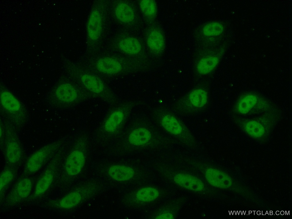 NCAPD3 Polyclonal antibody