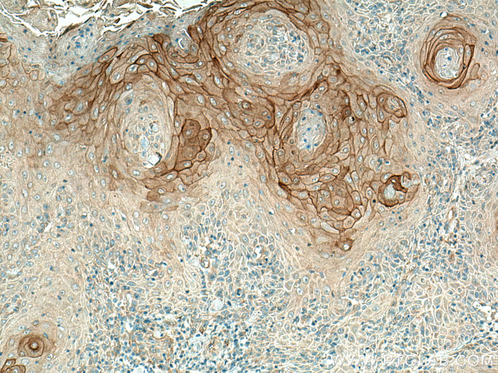 KRT80 Polyclonal antibody