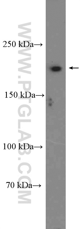SETBP1 Polyclonal antibody